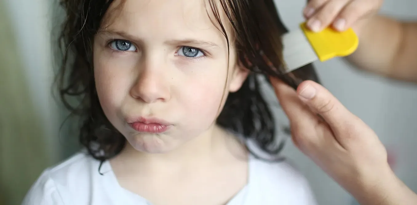 Pediyatrist ve anne: Bitlenme korkusuna gerek yok, işte doğru tedavi yöntemi
