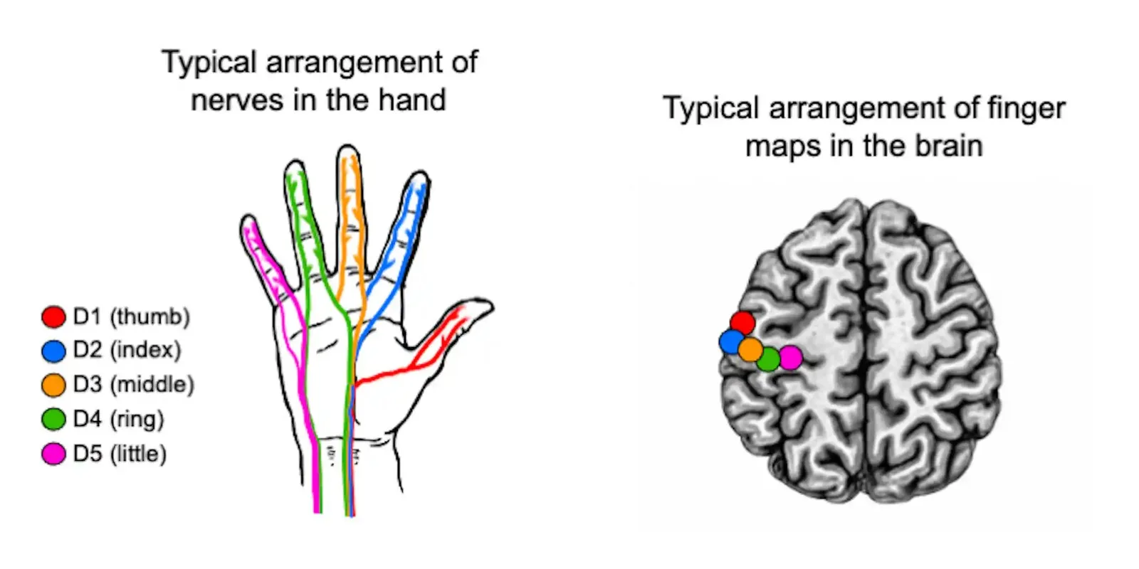 Diagram showing colour-coded nerves to the five fingers and their corresponding ordered finger maps in the brain.