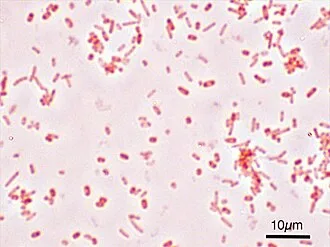 Salmonella enterica serovar Typhimurium (ATCC 14028), Gram boyama ardından mikroskopla 1000 kat büyütülerek görülmektedir.