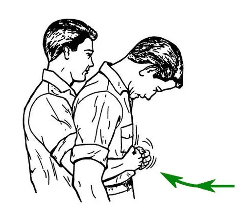 Abdominal thrusts against choking (cropped)